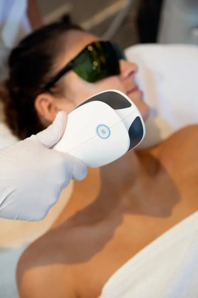 Laserontharing gezicht - Kik Your Skin